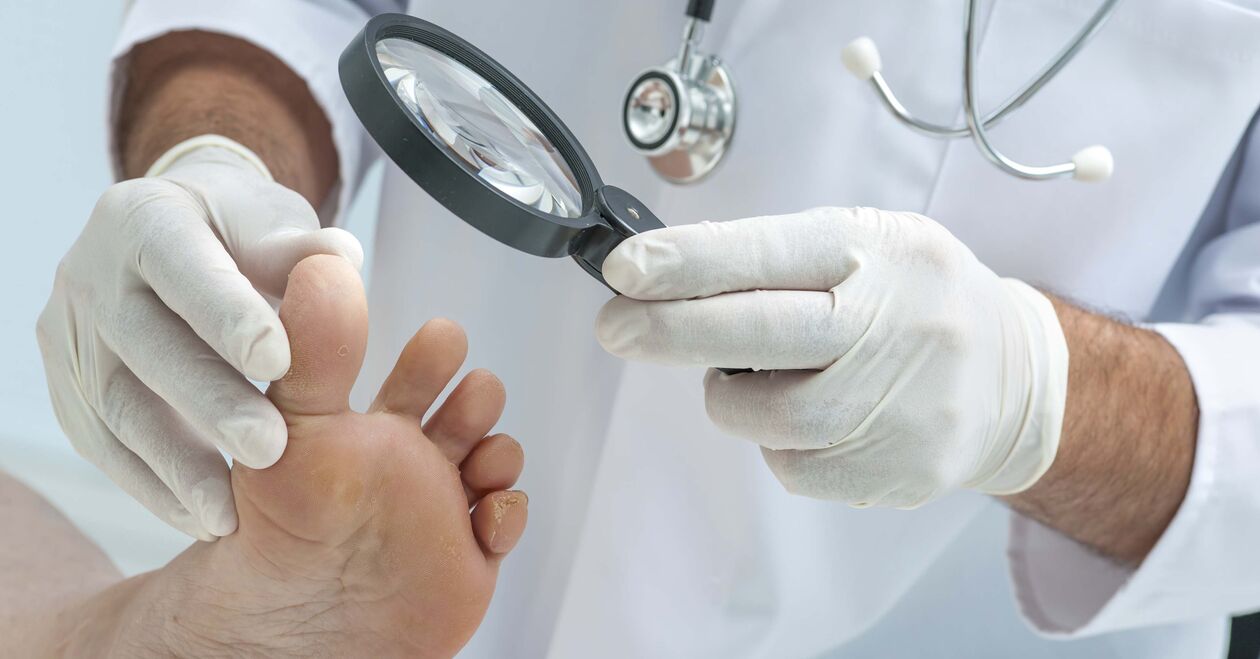 il medico esamina i piedi per i funghi delle unghie