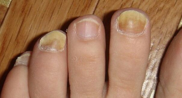 Cambiare il colore e la struttura delle unghie