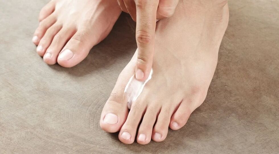 Applicare la crema dal fungo tra le dita