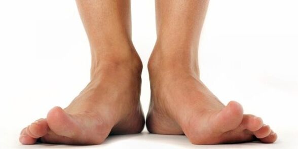 fungo sui piedi