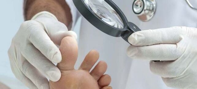 Esami prima di iniziare il trattamento fungino