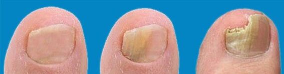 Processo di sviluppo dei funghi