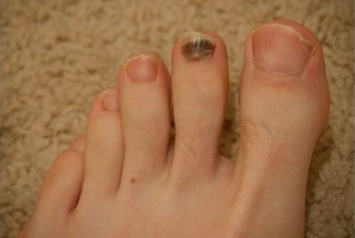 Uso di farmaci orali e topici