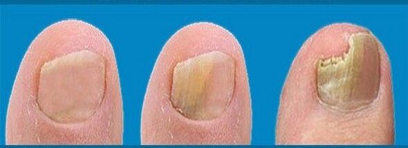 processo di sviluppo dei funghi